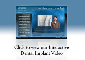 Click to view our Interactive Dental Implant Video